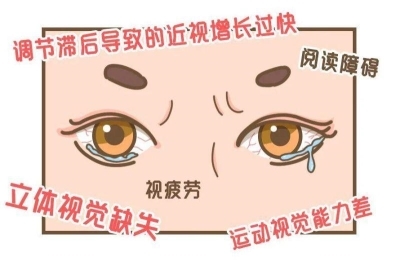 爱尔眼科：视觉训练有用吗？