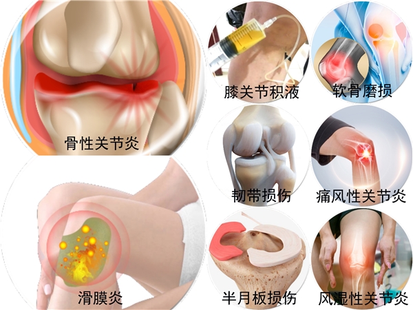 上海金博芙精准治疗膝关节病令九旬骨伤科专家赞叹