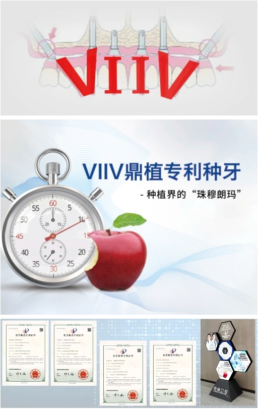 鼎植这样迎国庆：VIIV专利种牙再登央视！