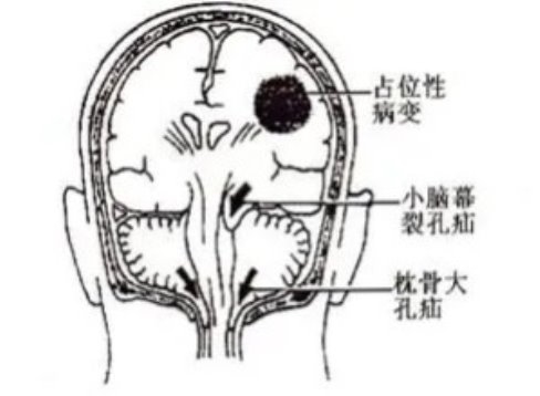 臂丛神经损伤怎么治？神经修复助少年摆脱束缚，绽放青春光彩