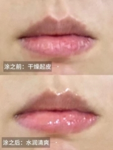 夏季敏感唇告急！别再乱用唇膏了