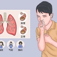慢阻肺患者的长期管理新策略